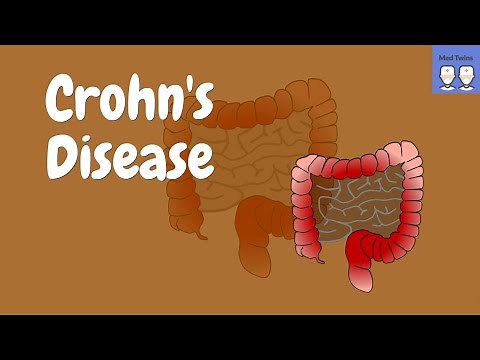 Crohn's disease [Pathophysiology, Gross & Microscopic morphology, Signs & Symptoms]