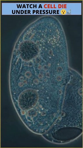 🦠 Cell's death under the microscope