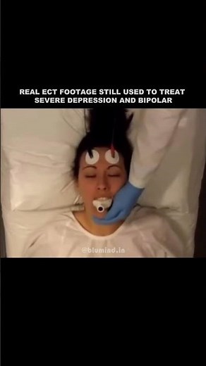 How ECT Looks in Real Medical Practice