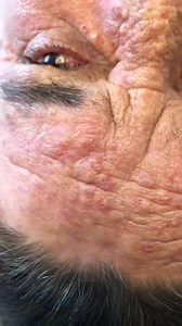 479K views · 2.1K reactions | #Parenting #acne #fblifestyle #spa #tratamientosfaciales #paratiiiiiiiiiiiiiiiiiiiiiiiiiiiiiii #fypviralシ #reelsvideoシ #fypシ | BEL_SPA | Facebook