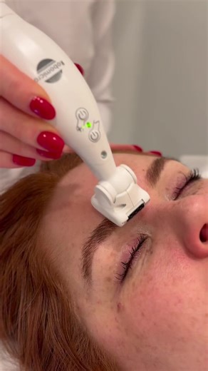 ICOONE Face Treatment: Transform Your Skin Today