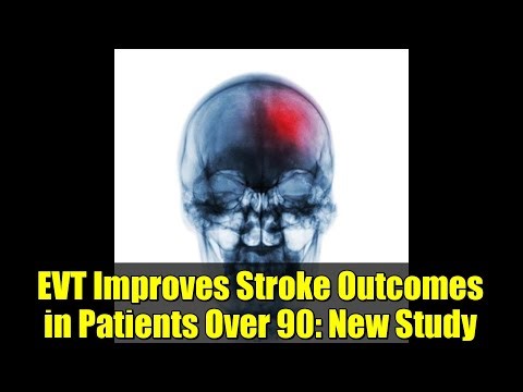 EVT Improves Stroke Outcomes in Patients Over 90: New Study