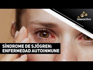 Sjögren's Syndrome: What is it and how to treat it?