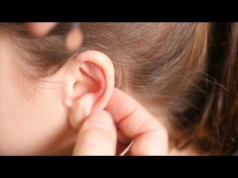 AcuPractice Videos: Ear Acupuncture Live Demo 7min 40sec