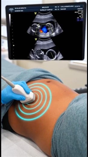 🌈 NATURE'S MIRACLE: The Doppler view that changes everything! 🧬❤️ #Shorts #baby #pregnant #viral