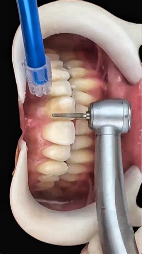 Стоматология | Зубной Техник | Москва on Instagram: "@dr_ricardogoncalves @arturio_dent - лектор в сфере съёмного протезирования @zirconium_line - циркон, который не надо сажать и красить и очень прочный на изгиб композит @yakoub.awanes - dental technician UAE - Abu dhabi @dentalfork - лучшие книги и инструменты для стоматологии @vivans_dens - опинион лидер ivoclar"