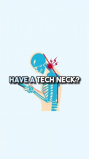 13K views · 150 reactions | How to Prevent Tech Neck The most obvious...