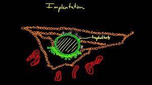 Implantation