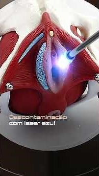 Therapy IA BLV - Fisioterapia