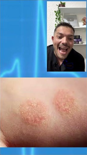 BACITRACIN (NEBACETIN) - WHAT IT'S FOR, HOW TO USE, HOW IT WORKS, SIDE EFFECTS - NEOMYCIN