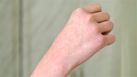 Subtle change in someone’s skin could be a sign they’re about to die