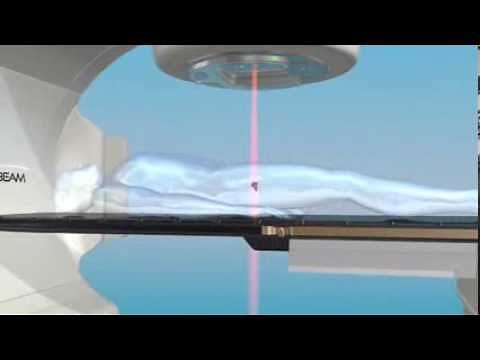 TrueBeam Image-Guided Radiation Therapy