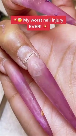 oh no 🤦‍♀️#nails #trending nail accident