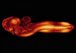 Quail imaging offers insights into congenital birth defects