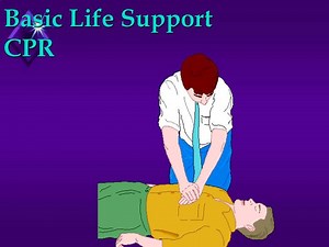 Basic Life Support CPR - SlideServe