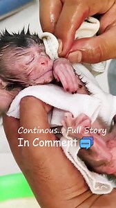 OMG! What Happened to the Baby Monkey?! 💔😢😭 This is truly heartbreaking… 💔 See the full story with pictures & video. 🔗 https://www.freshnewss.live/archives/645 | Adorable Tiny Monkey