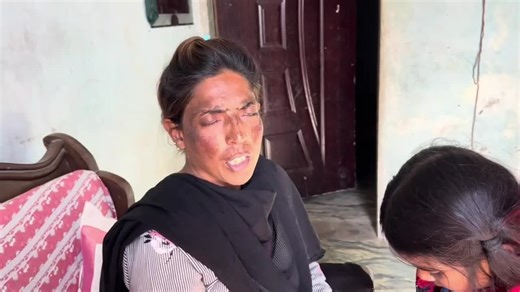 moh torh javb diye face py mask laga kr bht acha result Mila