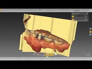 How to: Import Cerec to Exocad/3Shape