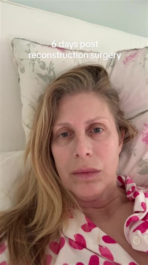 6 Days After Surgery: Recovery Update