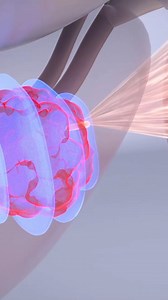 6.4K views · 187 reactions | Access Cleveland Clinic's free treatment guide to learn how prostate cancer is diagnosed, and the innovative treatment options available. | Cleveland Clinic | Facebook