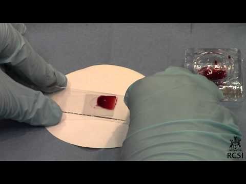 Dissection of male Locust testis, phases of Meiosis and Mitosis