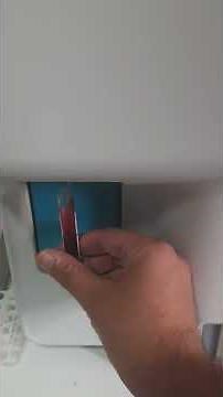 Sysmex XP300 hematology analyzer complete blood count cbc #bloodtest #shorts