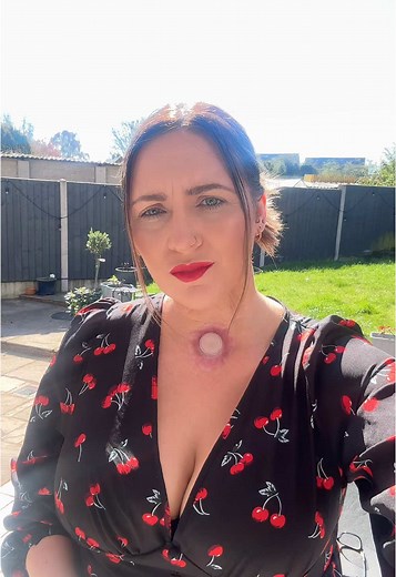 Life After Laryngectomy: A Survivor's Journey