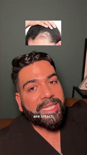 Female hair loss has three [common] causes...