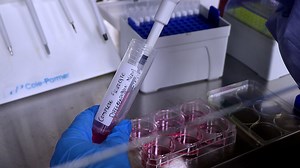 Robust Differentiation of Human iPSCs into a Pure Population of Adipocytes to Study Adipocyte-Associated Disorders