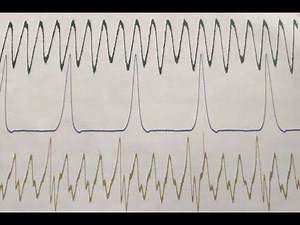 Intake and Exhaust Pressure Waveform Testing for Misfire