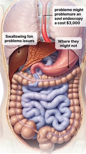 When Swallowing Problems Require $3,000 Endoscopy (And When They Don't)| Bio Anatomy Art|Gut Health