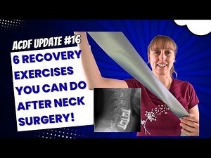 ACDF Recovery #16: Try These Top Physical Therapy Tricks for Neck Relief!