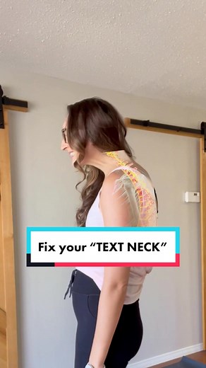 Effective Exercises to Correct Tech Neck Posture