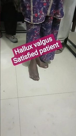 Hallux Valgus Corrected: A Successful Surgical Journey”