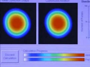 Advanced CustomVue Technology