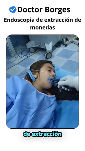 La endoscopia es un procedimiento médico que consiste en la inserción de un tubo flexible con una cámara en su extremo para visualizar el interior del cuerpo. En el caso de niños, la endoscopia es especialmente importante para extraer cuerpos extraños que se hayan ingestado o introducido en otras partes del cuerpo. | Doctor Borges