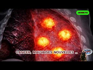 My fight against cancer: Scan results and new treatments (February 2026)