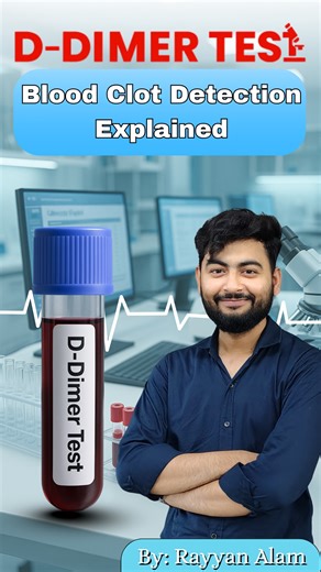 Rayyan Alam on Instagram: "🩸 D-Dimer Test – जानिए खून में क्लॉट बनने का इशारा देता ये ज़रूरी टेस्ट! अगर आपको अचानक सीने में दर्द, साँस लेने में तकलीफ, या सूजन हो रही है — तो ये टेस्ट आपकी जान बचा सकता है! जानिए D-Dimer Test कैसे काम करता है और क्यों डॉक्टर इसे COVID-19, Deep Vein Thrombosis (DVT) और Pulmonary Embolism में सलाह देते हैं। 👉 Swipe karo / Video dekho 💬 Apne doubts comments me poochho 📲 Save aur Share karo kisi zaruratmand ke saath - - - - - - - #ddimertest #bloodtest #labtestexp