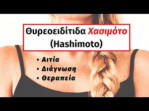 Θυρεοειδίτιδα Χασιμότο: Διάγνωση και θεραπεία