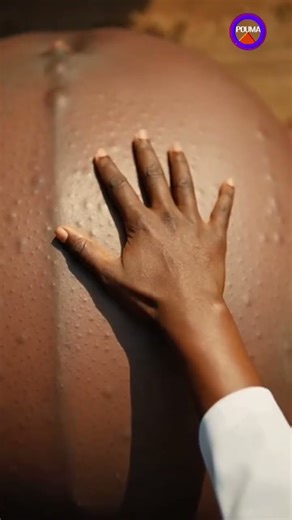 When God Heals 5 | izon tv | pastor pouma | yawa skits | Christian