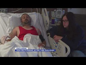 Man injured after tire explosion recovering slowly
