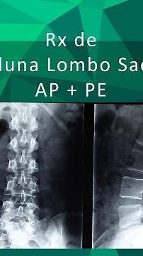 Radiograph of the Lumbosacral Spine AP + Profile - Orthostatic