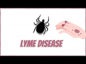 Lyme Disease: Signs and symptoms, diagnosis and treatment