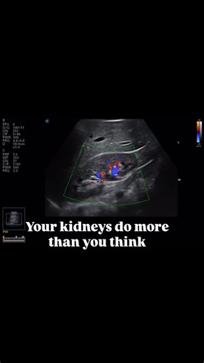 A kidney ultrasound may be recommended when symptoms suggest an underlying issue. Common reasons include: * Flank or lower back pain * Blood in the urine * Recurrent urinary tract infections * Difficulty or pain with urination * Abnormal kidney lab results * History of kidney stones Ultrasound is a safe, noninvasive way to evaluate kidney size, structure, stones, obstruction, and fluid buildup—without radiation. Book your kidney and bladder ultrasound today at nolaultrasound.com #nolaultrasound 