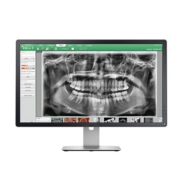 EzDent-i - 2D Software - VATECH