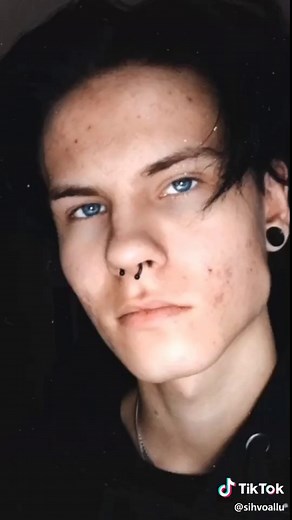 Oliko up vai down? #glowup #foryou #fry #fyp #comedy #meme #acne #funny