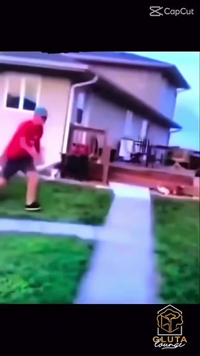 Tinkerbell Nose Lift Procedure for Natural-Looking Nose Enhancement