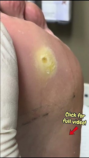 Part 2 - Deep Corn Extraction Close-Up 🔍 #satisfying #satisfyingshorts #shortsfeed