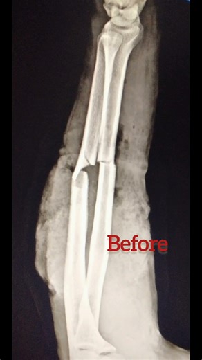 Before xray And After x-ray ☢️⚡ #radiology #radiography #xray #aiims #paramedical #medical #anatomy
