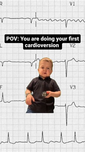 Simply ECG on Instagram: "First cardioversion  #ecg #ecginterpretation #cardiology #medical #medicine #medschool #medicalstudent #nurses #doctors #paramedics #humor #joke #arrhythmia #cardioversion"